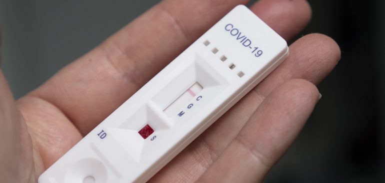 Miniatura de TCDF apura supostas irregularidades em fornecimento de 100 mil testes de Covid-19 ao Governo do DF 